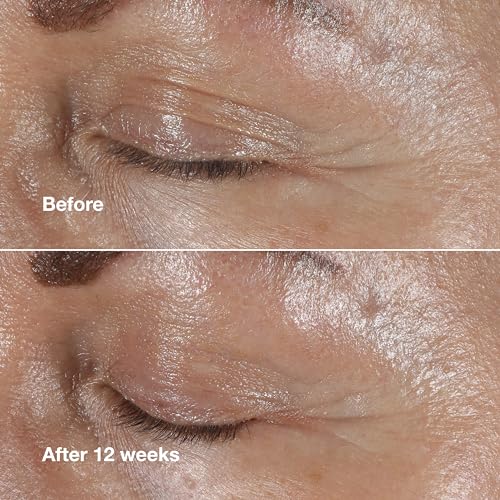 Clinique Smart Clinical Repair Eye Cream with Hyaluronic Acid & Peptides - Image 4